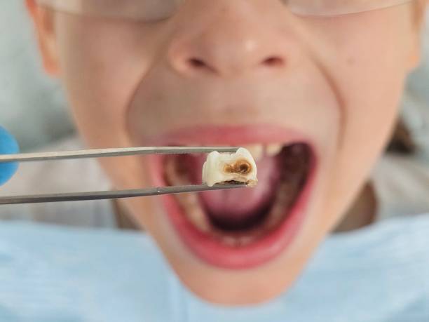 Best Emergency Cosmetic Dentistry (e.g., broken veneers) in Konawa, OK